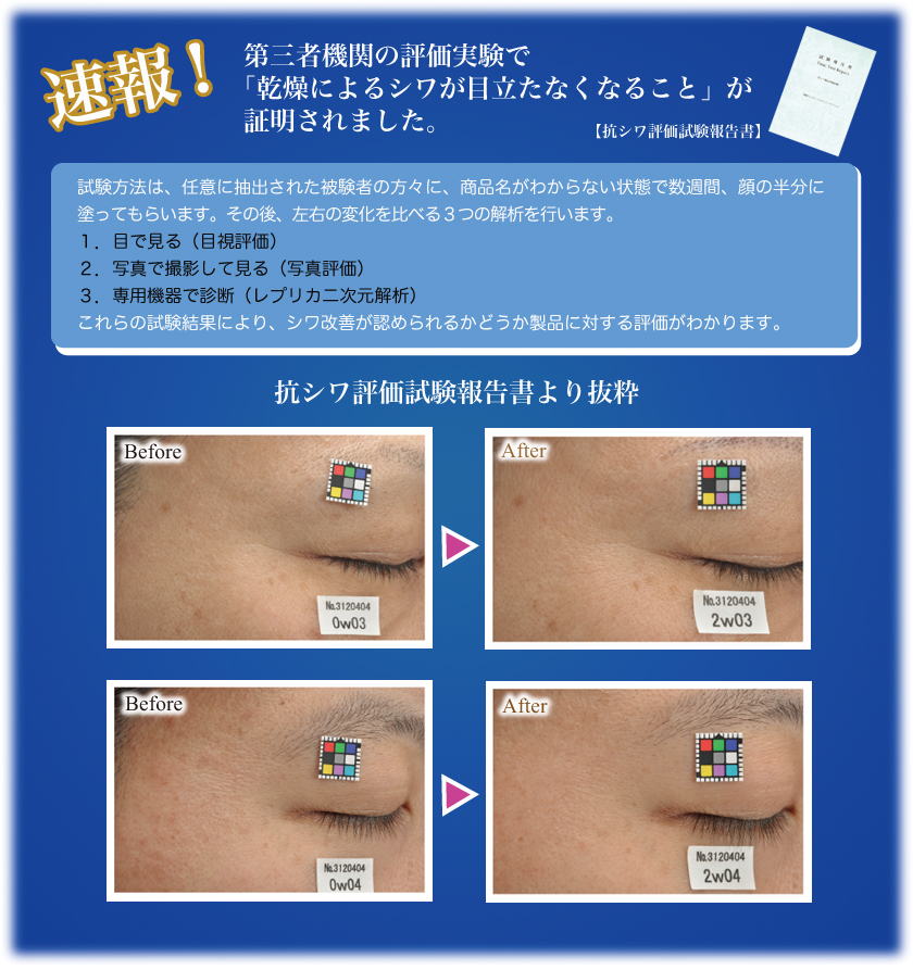 高保湿・ふっくら仕上げる目元口元専用美容液 50代女性に今話題の人気アイテム